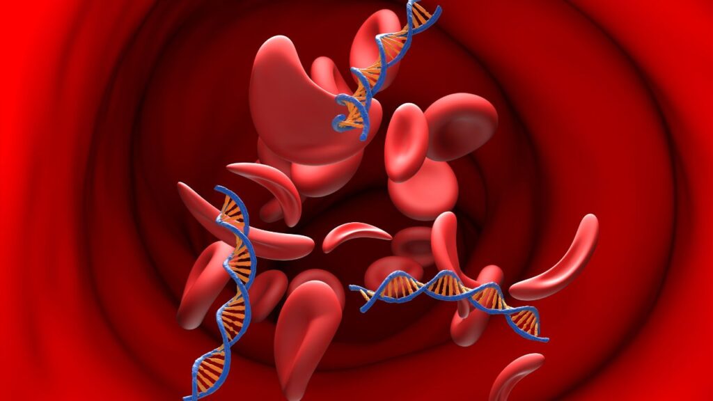 stem-cell- therapy